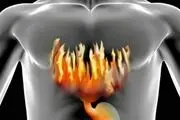 ریفلاکس معده را چگونه درمان کنیم؟