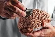 پیری زودرس موجب این اختلال روانی می‌شود