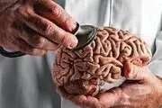 پیری زودرس موجب این اختلال روانی می‌شود