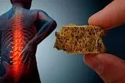  جلوگیری از پوکی استخوان با یک روش ساده