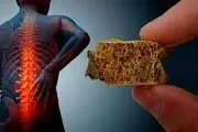  جلوگیری از پوکی استخوان با یک روش ساده