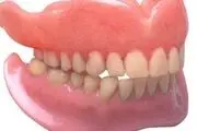 تغییر رنگ لثه را جدی بگیرید