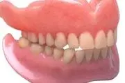 تغییر رنگ لثه را جدی بگیرید