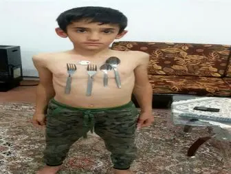 پسر بچه پلدشتی با بدن آهن ربایی+ تصاویر