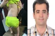 جراح کواری یکی از نادرترین ناهنجاری های مادرزادی را درمان کرد