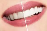 با این راه حل‌های ساده با دندان درد شب خداحافظی کنید