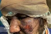 تصاویر دردناک از وضعیت وحشتناک مجروحان حملات به مردم (