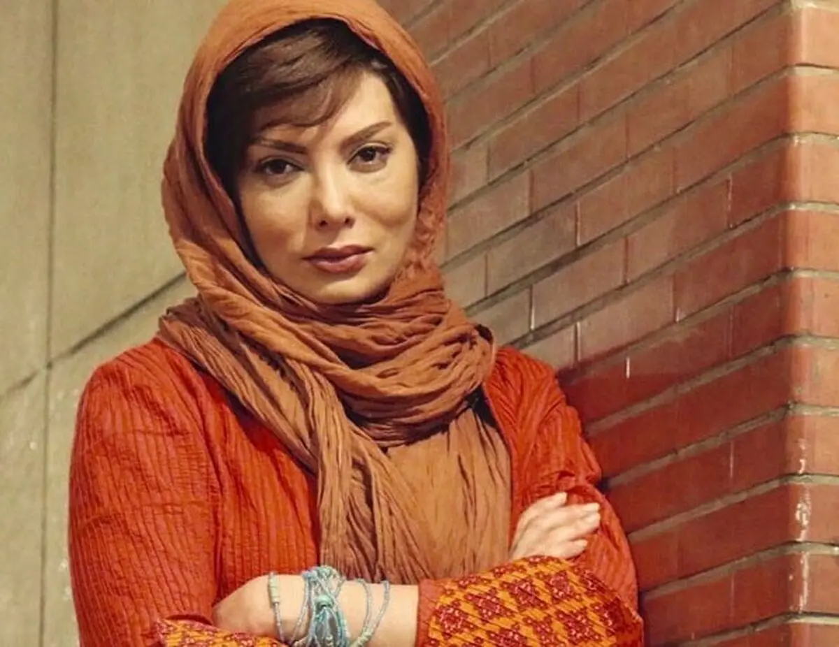 خانم بازیگر از دلایل جراحی بینی اش پرده برداشت/ عکس