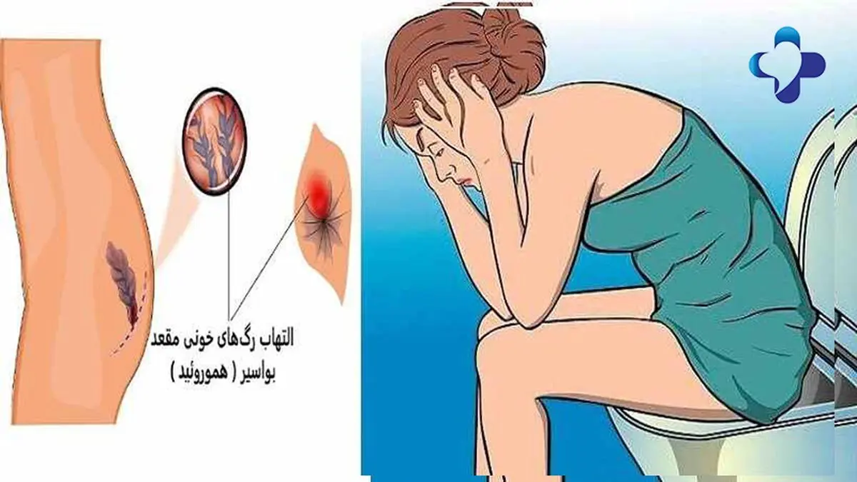 کلینیک هیلینگ - مرکز بیماری های نشیمنگاهی