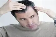 نکات مهم در بهداشت و سلامت مو /اشتباهات رایج در بهداشت مو