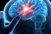 زنان قد بلند بیشتر سکته مغزی و قلبی می‌‌کنند