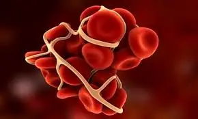 ۱۱ عامل موثر بر افزایش خطر لخته شدن خون