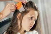 
۵ درمان شپش سر که بسیار مؤثر هستند