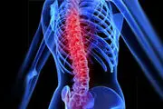 برای جلوگیری از قوز کردن چه کنیم؟