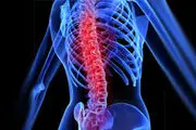 برای جلوگیری از قوز کردن چه کنیم؟