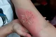 این نقش و نگارهایی که سلامت‌ شما را هدف گرفته‌اند