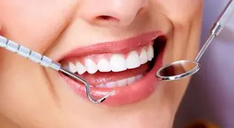 دشمن سلامت و زیبایی دندان چیست؟