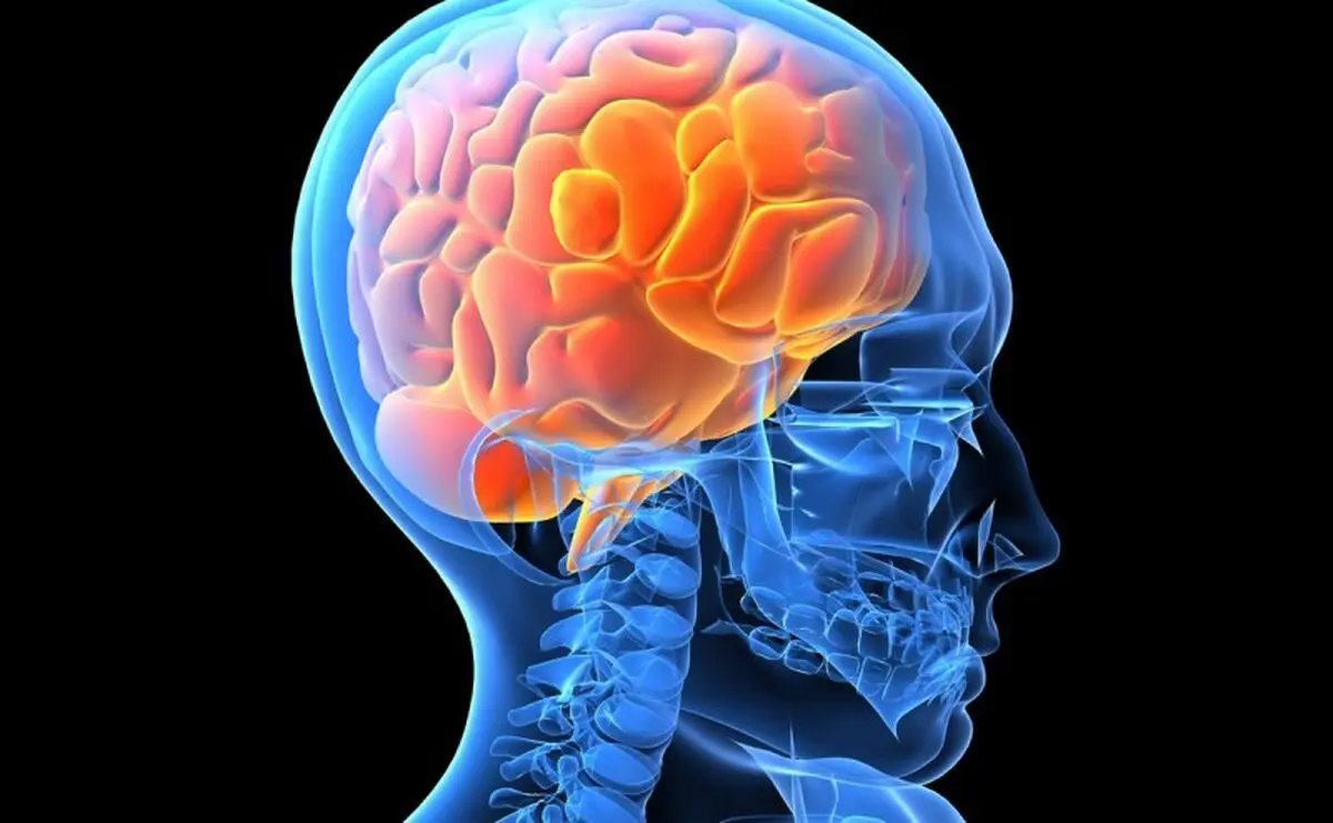  علائم هشدار دهنده سکته مغزی 