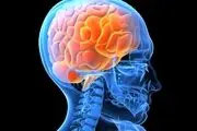 علامت سلامت مغز چیست؟