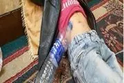 هزینه‌های پزشکی کَمَرَم را شکسته