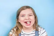 
اگر به جویدن یخ علاقه دارید بخوانید!