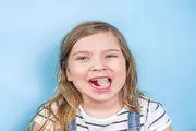 
اگر به جویدن یخ علاقه دارید بخوانید!