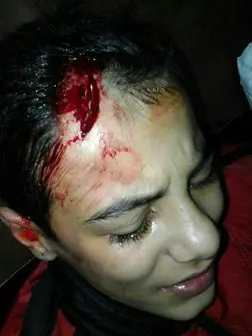 پسر دستفروش در تالش، توسط ماموران شهرداری زخمی نشده است