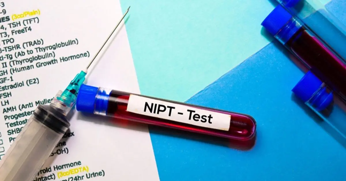 تشخیص اختلالات ژنتیکی قبل از تولد با آزمایش NIPT