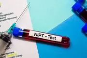 تشخیص اختلالات ژنتیکی قبل از تولد با آزمایش NIPT