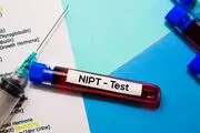 تشخیص اختلالات ژنتیکی قبل از تولد با آزمایش NIPT