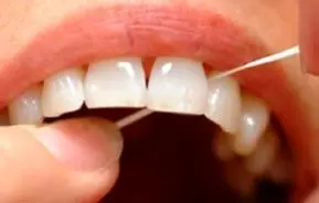عدم استفاده از نخ دندان شما را می‌کشد