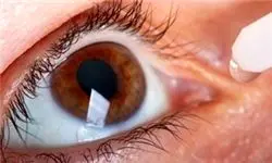 مهمترین عامل بیرون‌زدگی چشم چیست؟