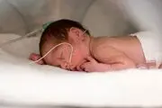 پیش‌بینی زایمان زودرس با نشانگرهای زیستی اپی ژنتیک