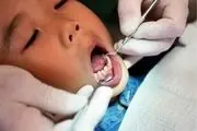  خدمات دندانپزشکی رایگان به دانش آموزان ابتدایی شهرستان کهگیلویه ارائه می‌شود 