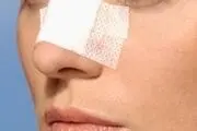 روش های جراحی زیبایی بینی
