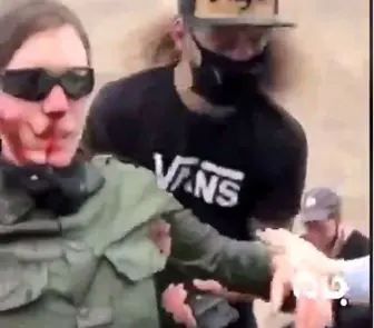 شلیک پلیس آمریکا به صورت زن معترض/فیلم