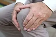بیماری آسم و اگزما ریسک آرتروز را افزایش می دهد