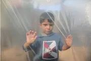 ۵۴ هزار کودک زیر پنج سال قربانی سوءتغذیه حاد