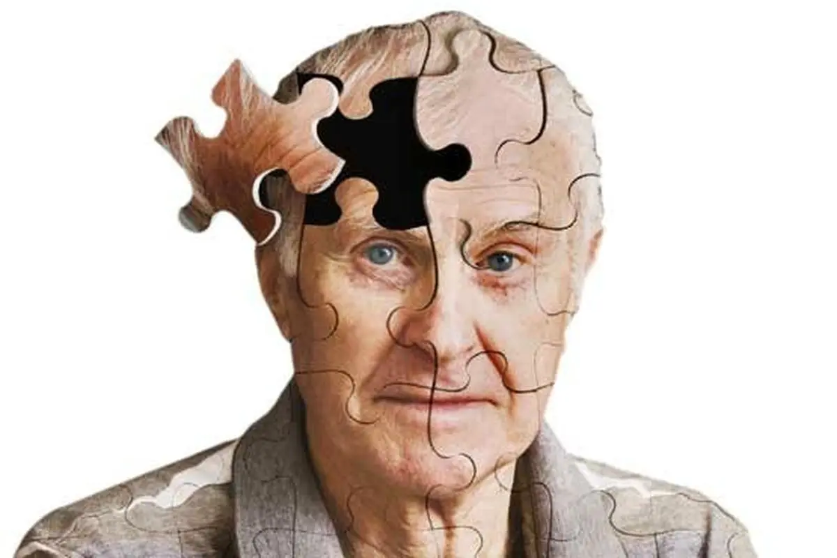 برای پیشگیری از آلزایمر این غذاها را بخورید