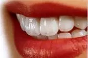 چه عادت های باعثخرابی دندان ها می شود؟