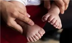 تلاش پزشکان چینی برای حذف انگشتان اضافی نوزاد 31 انگشتی 