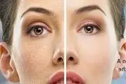 این مواد غذایی را بخورید تا پیر نشوید