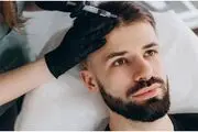 مزوتراپی چیست؟  معرفی مراکز برتر زیبایی در سایت پی جو