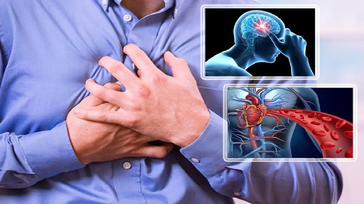 سکته قلبی و مغزی از مهمترین تبعات گرفتگی عروق