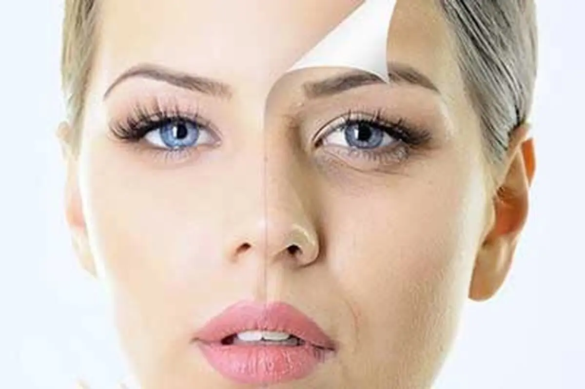 یک صابون خانگی شگفت انگیز برای لکه های صورت +طرز تهیه