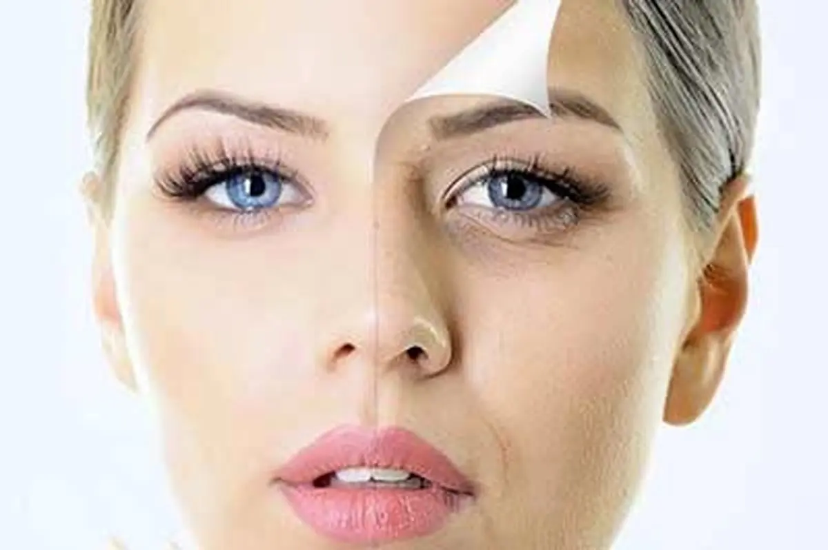 راهی برای جلوگیری از چین و چروکهای صورت