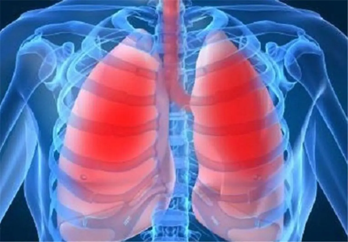 چه کسانی بیشتر در معرض ابتلا به بیماری ریوی هستند؟