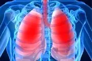 مراقبت از ریه ها در فصل سرما 