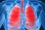 دلیل وحشتناک خستگی و تنگی نفس دائمی بهبود یافتگان از کرونا
