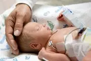 چه ارتباطی میان فواصل کوتاه زایمان و مرگ نوزادان وجود دارد؟